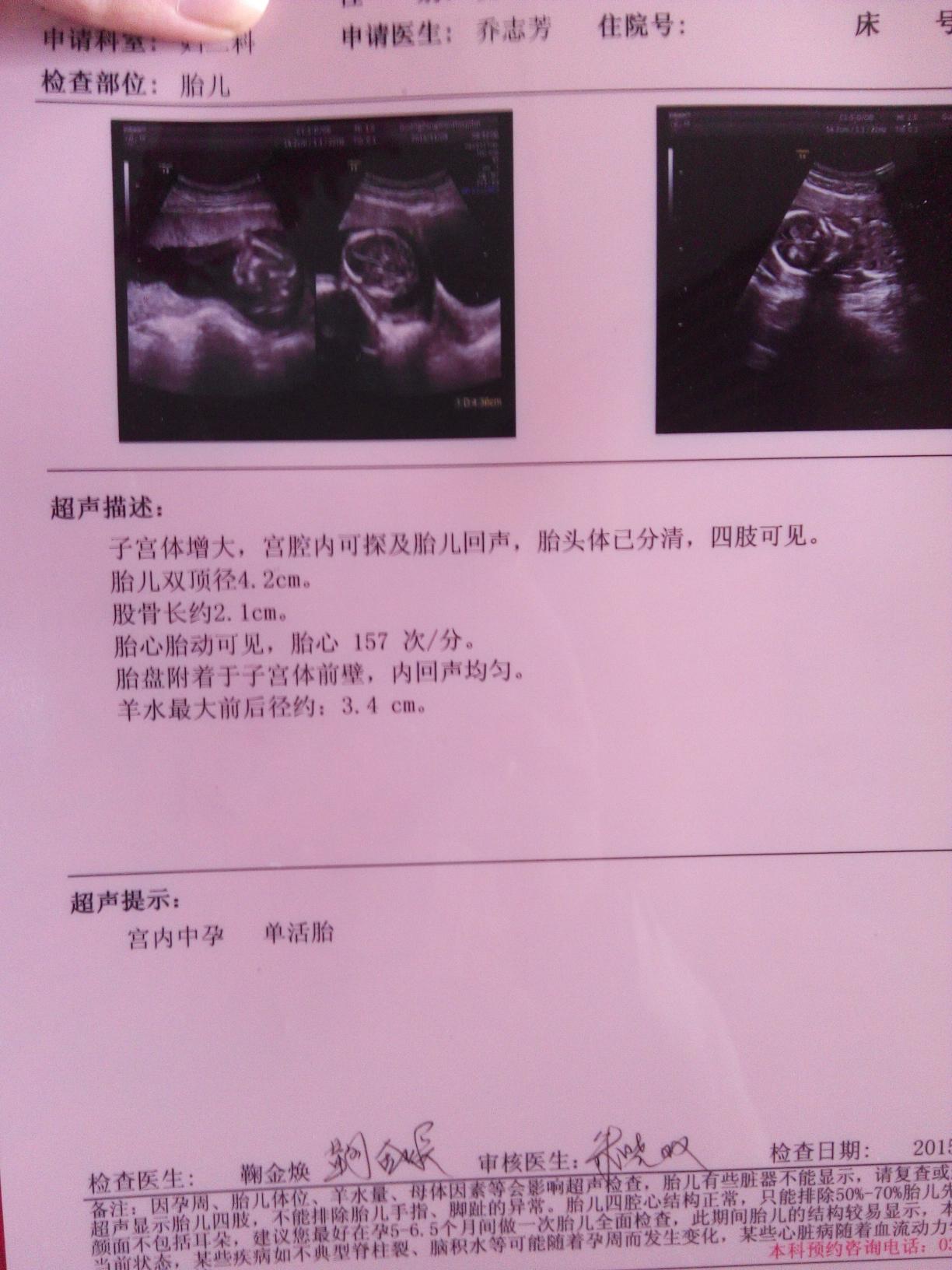 ky.com_加快三双部署，中国经济迈向速稳质优时代(图3)